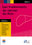 Les traitements du cancer du foie